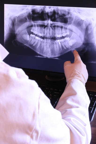 Best Emergency Dentist for Knocked-Out Tooth in Ballenger Creek, MD