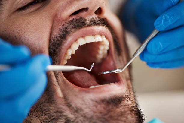 Best Broken or Cracked Tooth Emergency Dentist in Ballenger Creek, MD